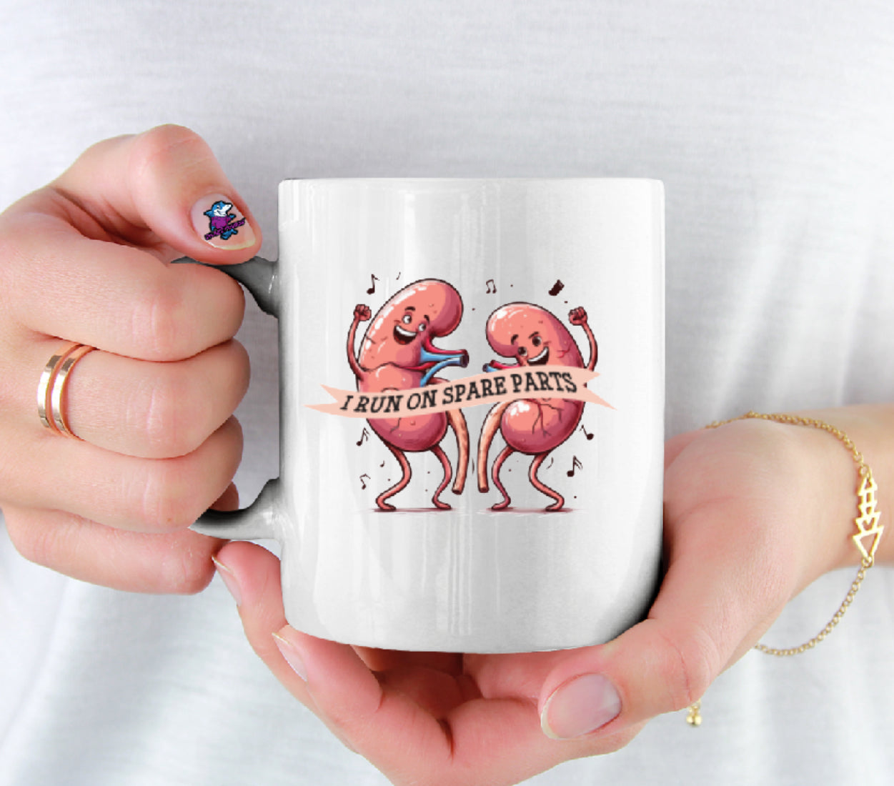 I Run On Spare Parts (Kidney Transplant Awareness) 11oz Cup Mug Kidney Survivor Gift